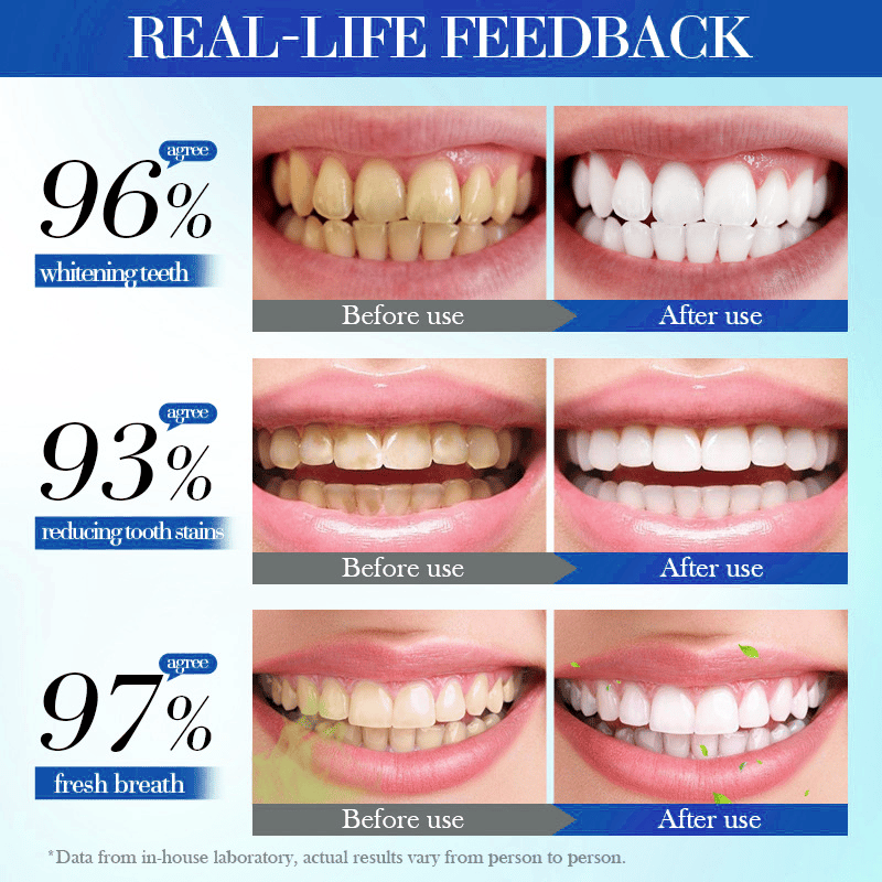 🔥BUY 2 GET 1 FREE🔥Beamach Hydroxyapatite Toothpaste 7.5% for Enamel Teeth Whitening Refreshing Flavor Fluorid