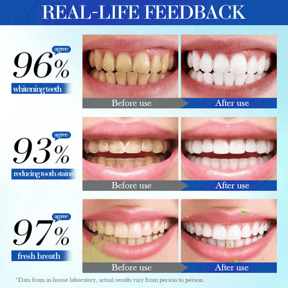 🔥BUY 2 GET 1 FREE🔥Beamach Hydroxyapatite Toothpaste 7.5% for Enamel Teeth Whitening Refreshing Flavor Fluorid