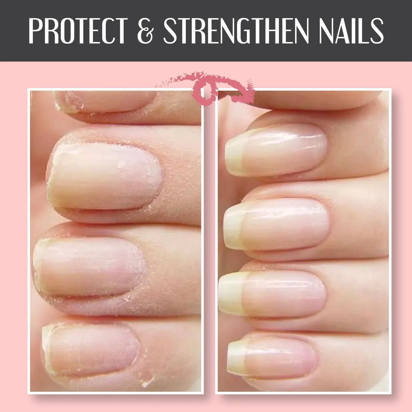 Christmas Promotion🎄 Buy 2 Get 1 Free-Instant Nail Repair Protect Gel