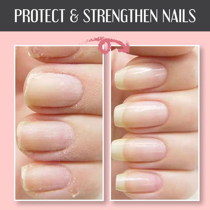 Christmas Promotion🎄 Buy 2 Get 1 Free-Instant Nail Repair Protect Gel